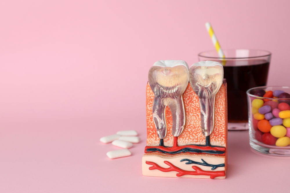 foods and drinks to avoid with dental bridges