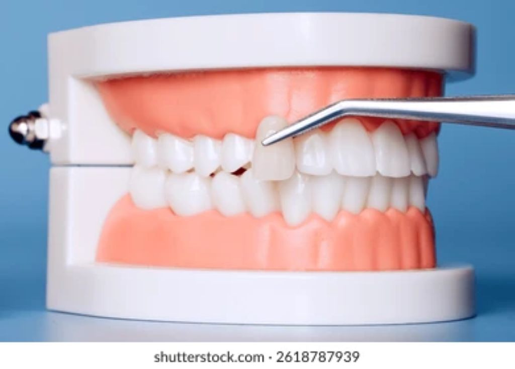 how cosmetic dentistry improves your smile