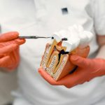 how root canal treatment saves your natural tooth